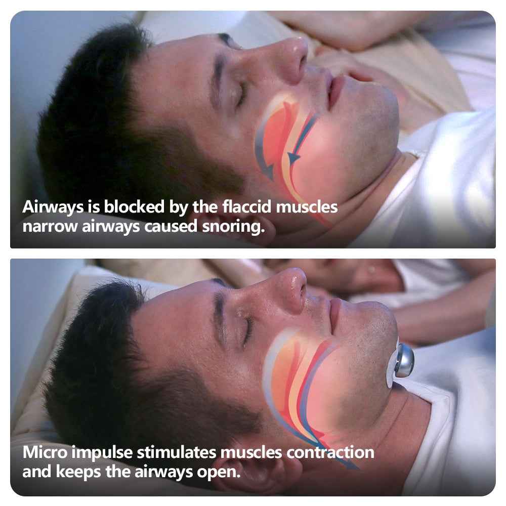 Smart Anti Snoring Device Electronic Muscle Stimulator Pro - EZEEGET