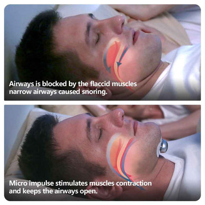 Smart Anti Snoring Device Electronic Muscle Stimulator Pro - EZEEGET